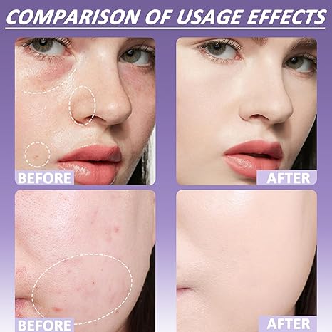 🔥 LETZTER TAG 49 % RABATT🔥Soft Matte Cream Concealer