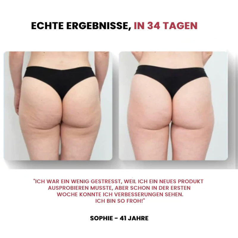Elektrisches Schröpfgerät/Electric cupping device