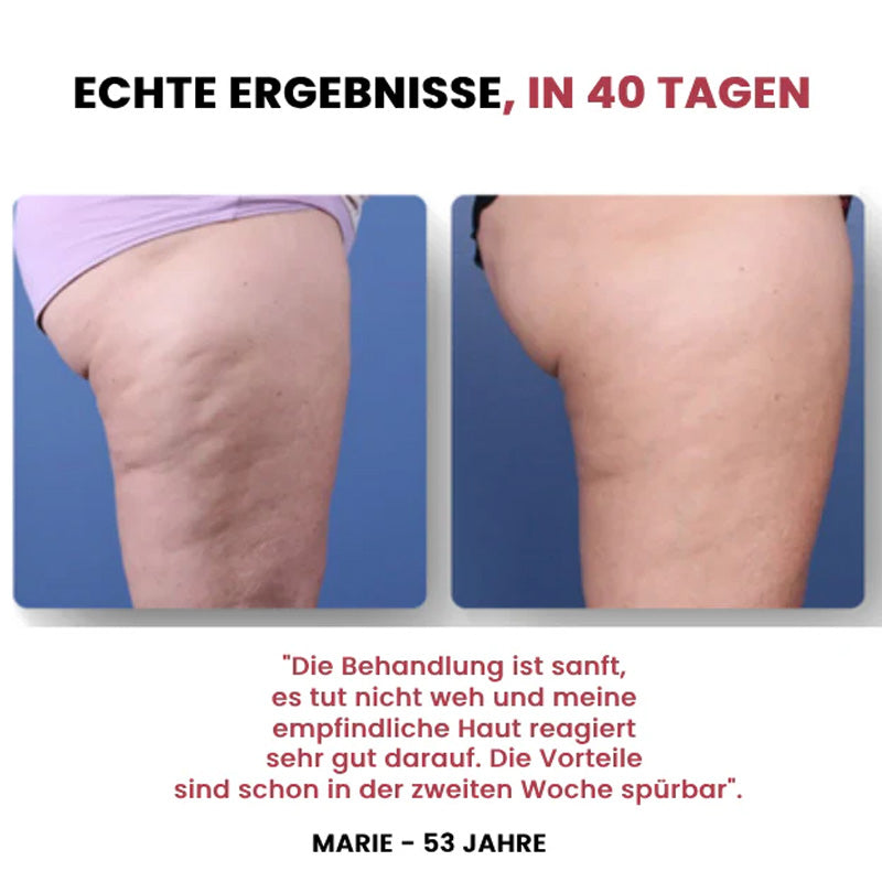 Elektrisches Schröpfgerät/Electric cupping device