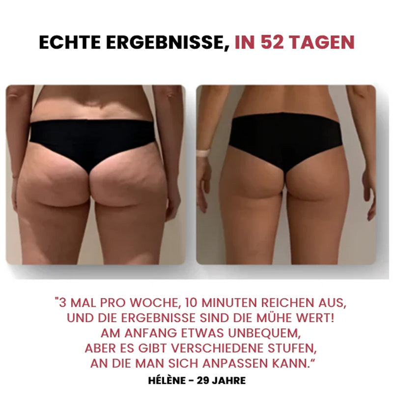Elektrisches Schröpfgerät/Electric cupping device