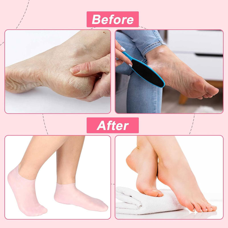 Peeling-Strandsocken aus Silikon – verjüngen Sie Ihre Füße! 👣💕