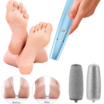 🔥Hot Sale - 50% OFF🔥Elektrischer Hornhautentferner für die Füße⚡