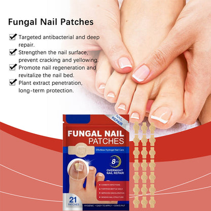 Nagelpilzpflaster – Schnell wirkende, einfach anzuwendende Nagelpflege