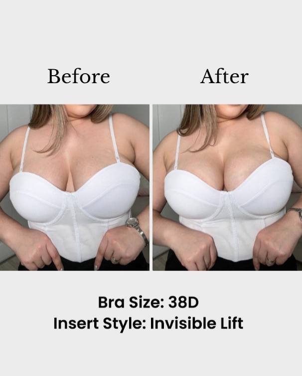 🔥BLITZVERKAUF🔥Unsichtbare Lift-Einsätze | Doppelseitig klebender BH-Lifter für sofortigen Boost