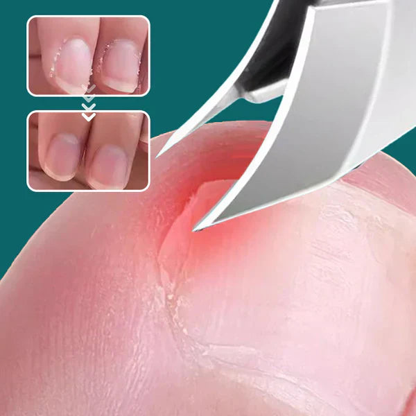 Rutschfester Nagelknipser mit abgeschrägter Kante, 3-teiliges Set
